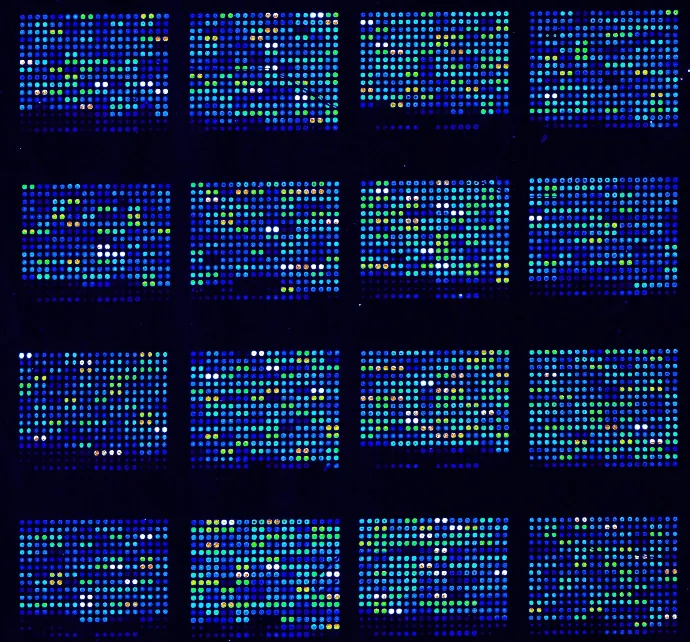 Array de anticuerpos para biomarcadores